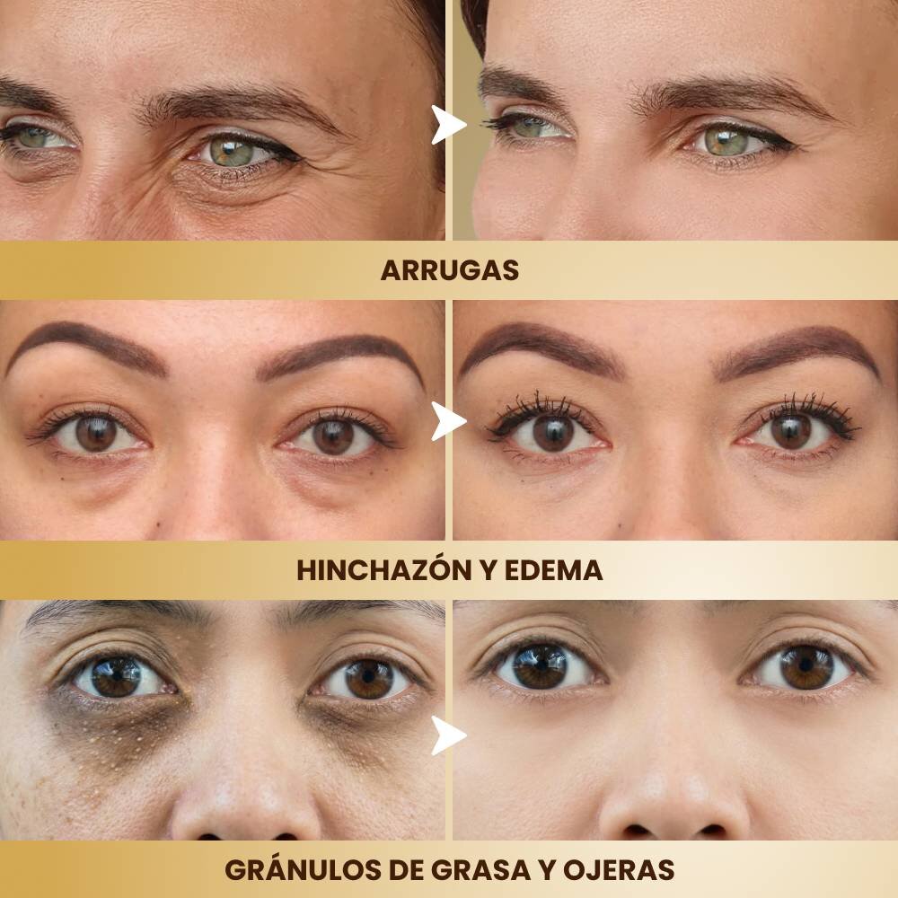 GloraMD image