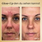 GloraMD image