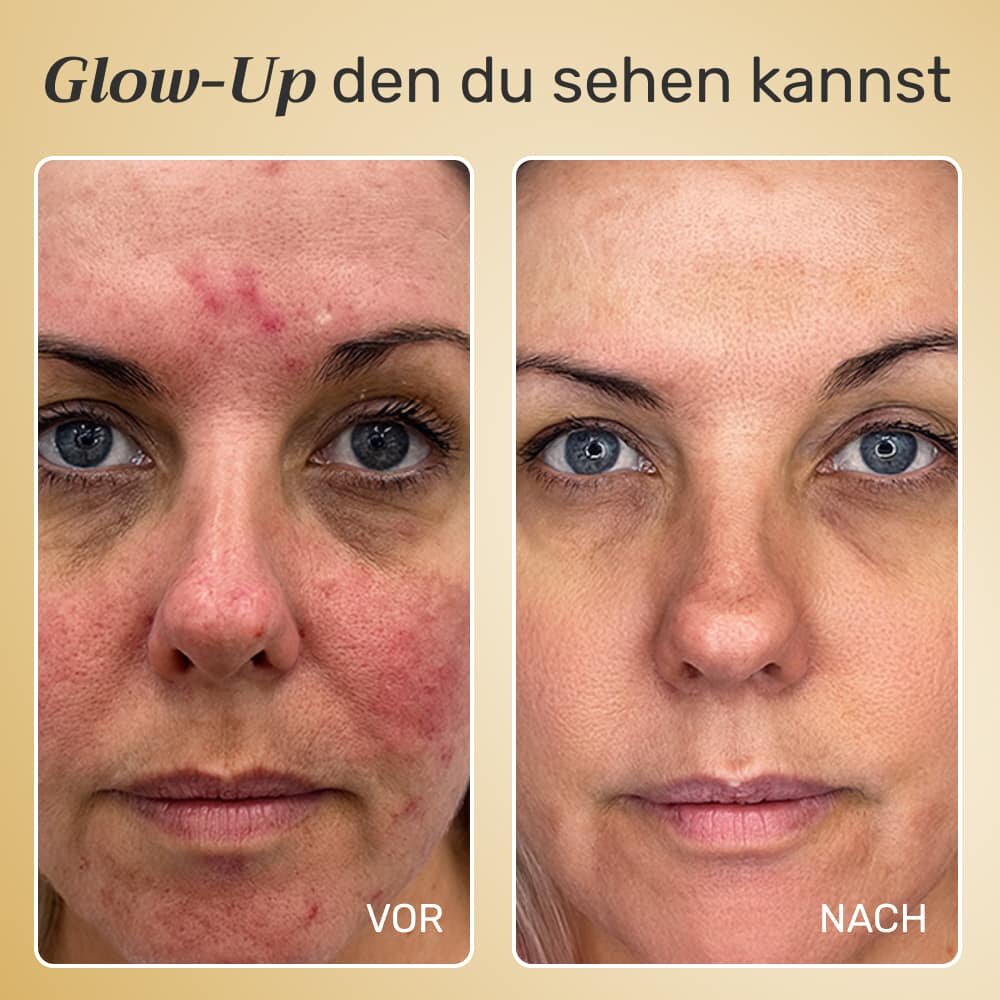 GloraMD image