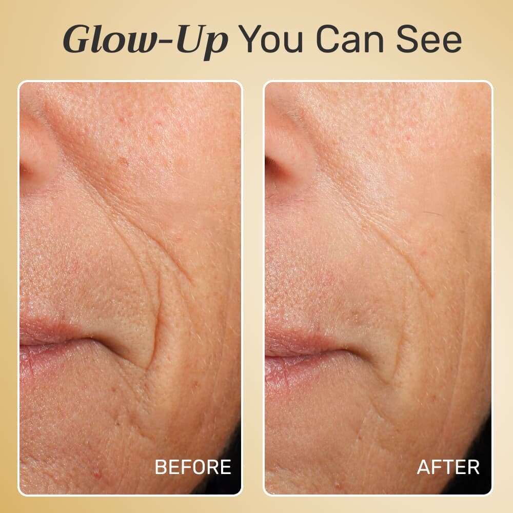 GloraMD image